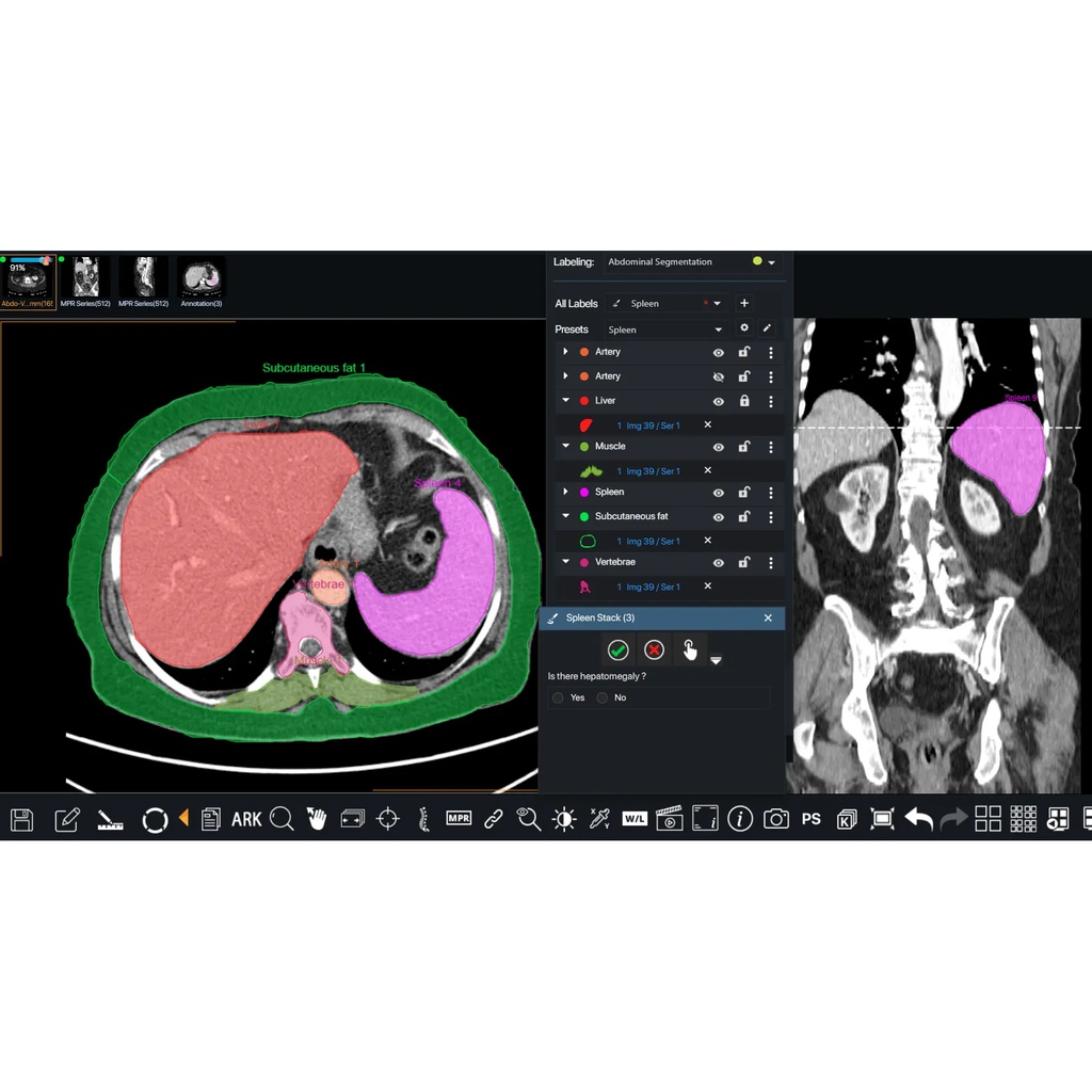 Open AI platform for Imaging Algorithms